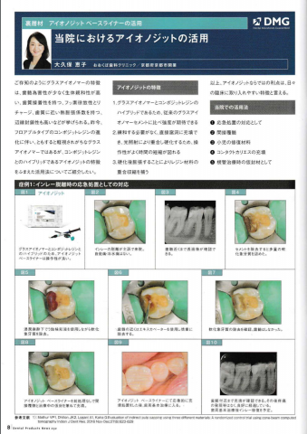 「YOSHIDA Dental Products News」に院長の記事が掲載されました