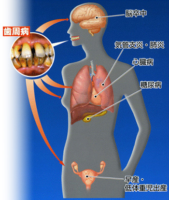 京都市左京区 おおくぼ歯科クリニック 歯周病治療